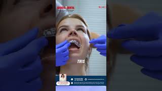 Root Canal or Extraction? Save your tooth or remove it? Find out what’s best for your oral health!🦷