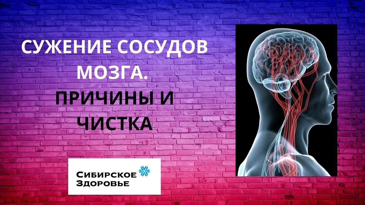 Сибирское здоровье для мозга и сосудов. Сибирское здоровье для сосудов головного мозга и сосудов шеи. Очищение сосудов от Сибирского здоровья. Почему сужаются сосуды