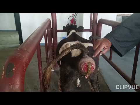 Tenesmus Or Sever Straining