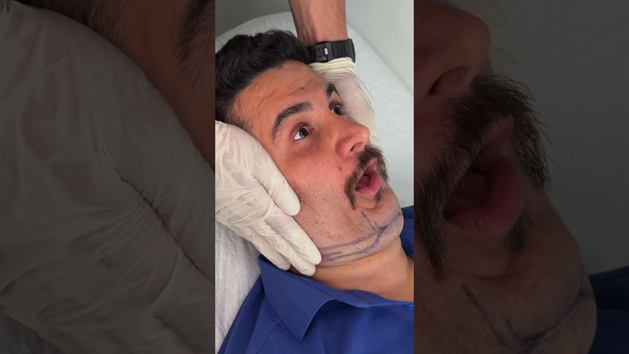 Real Face Exercises‼️