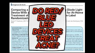 Debunking latest study on LED device to treat acne