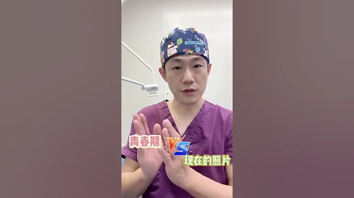 【毛发知识】怎么判断天生发际线高还是后移了？这就告诉你自检方法！ - 天天要闻