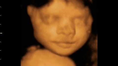 3D 4D Ultrasound baby scan. The Original Window to the Womb Ltd