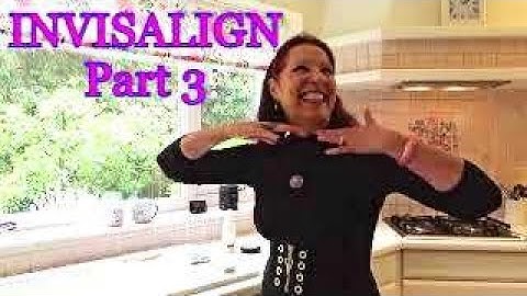 My "INVISALIGN" JOURNEY - Part 3 (Week 26 of 34)