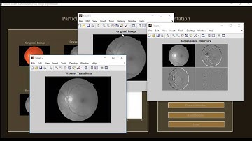 Particle Swarm Optimization image segmentation matlab projects