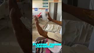 Flapping Tremors- Encephalopathy