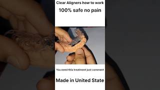 Clear Aligners #aligner #dentist#DRIshratMafruha #Denta #shorts #machine #dental