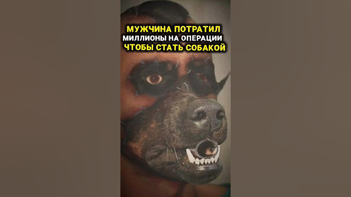 Пересадил себе лицо и шерсть от собаки #невероятныефакты #удивительное #реальныеистории