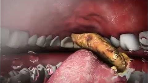 Mechanical Digestion And Chewing: Learn@Visible Body