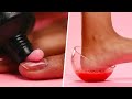 Dry Feet Treatment 🍓 PROFESSIONAL BEAUTY HACKS AT HOME #shorts #beautytips