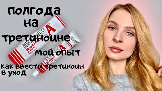 ПОЛГОДА НА ТРЕТИНОИНЕ 😱💜 Мой опыт использования третиноина 👸Средство ПРОТИВ МОРЩИН и ПРЫЩЕЙ💉