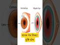 निकट दृष्टि दोष मायोपिया (Myopia) क्या है? 👁️ दूर की चीज़ें धुंधली क्यों दिखती हैं? #shorts