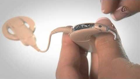 Locking and unlocking the sound processor (Simple User Interface)