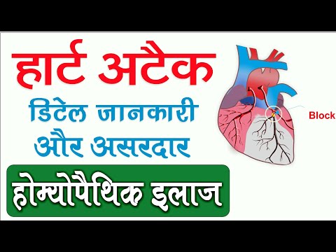 heart-attack:-causes,-symptoms,-diagnosis-&-emergency-treatment-by-homeopathic-medicines