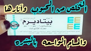 تجربتي مع بيتاديرم وازاي تخلصت من الحبوب والالتهابات اللي كانت بتظهر فبشرتي