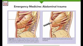 How Penetrating Abdominal Injuries can Cause secondary Peritonitis