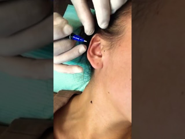 Почему бы и нет 😉✌🏼 Сразу 5 проколов !