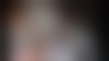 Robotic Left Upper Lobe Trisegmentectomy - Intermediate