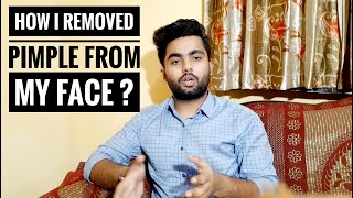 How To Get Rid Of ACNE In Hindi | Remove Pimple And Acne Permanently At Home | BeFit
