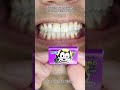 Most Satisfying Candy &amp; Chocolate ASMR 🍫🍬 #DoctorTristanPeh #ASMR