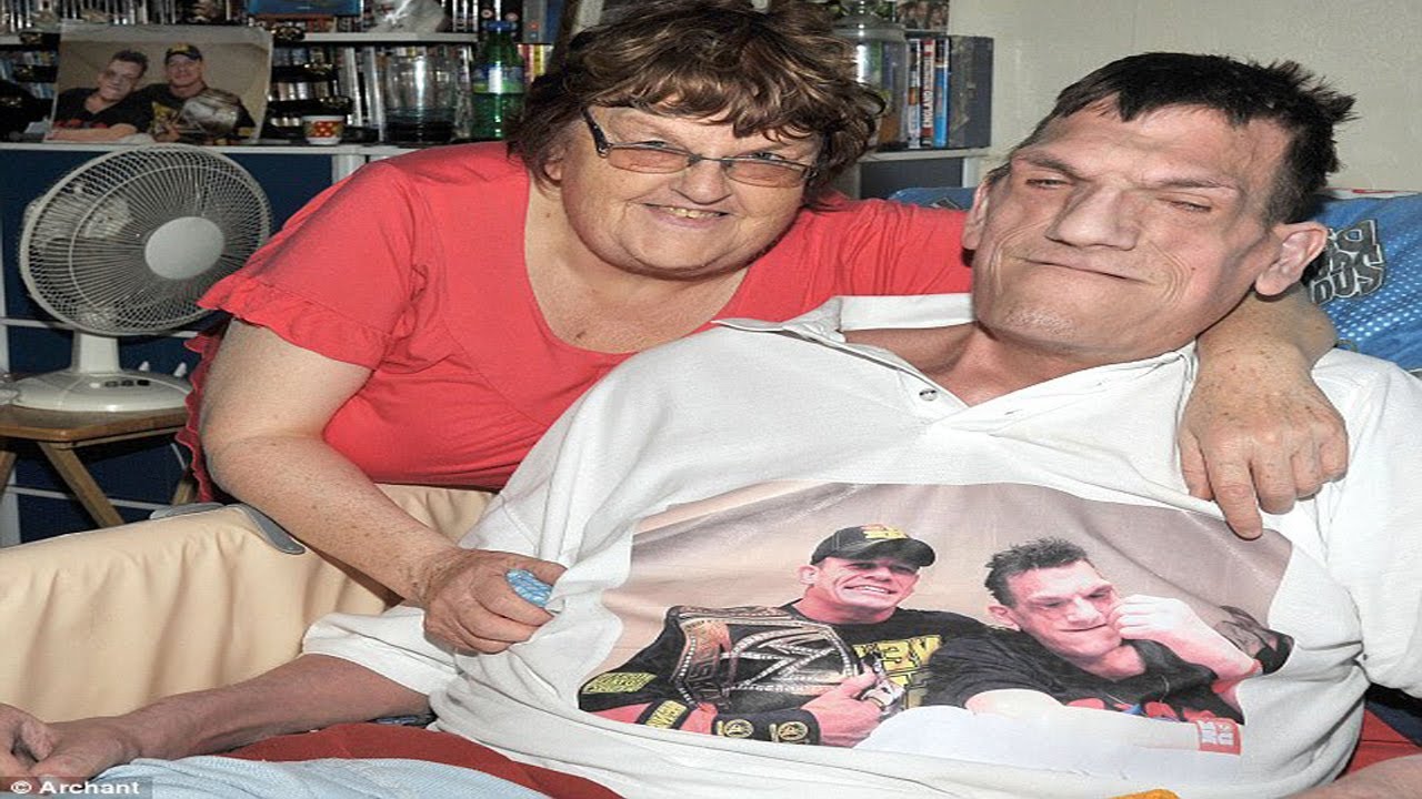 24-yr-old-man-cant-stop-growing-rare-condition-youtube