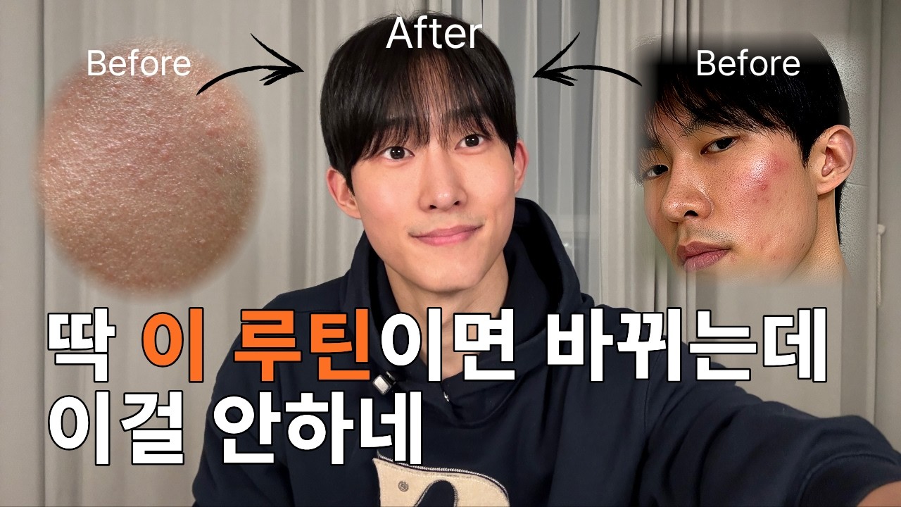 피부장벽 회복, 따라하면 단 7일만에 피부 좋아집니다 (+재생 크림 추천)