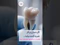اگر دندان کنده بشه