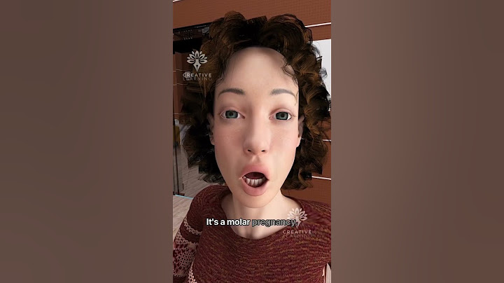 Elle pensait être enceinte… mais ce n’était pas un bébé 😱 #court - Creativelearning3d