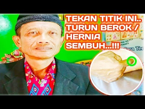 TEKAN POINT INI...!!! HERNIA / TURUN OKAY JADI SEMBUH..!!!