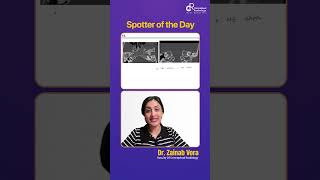Spotter of the Day by Dr. Zainab Vora | Conceptual Radiology | Radioogy Residency #shorts
