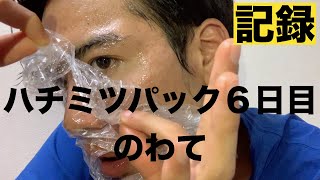 美容動画 ニキビアレルギーに気づくハチミツパック１週間記録６日目 Youtube