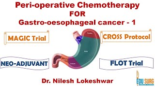 Chemotherapy in gastric cancer & esophageal cancer  Basis, MAGIC trial, FLOT trial, CROSS protocol