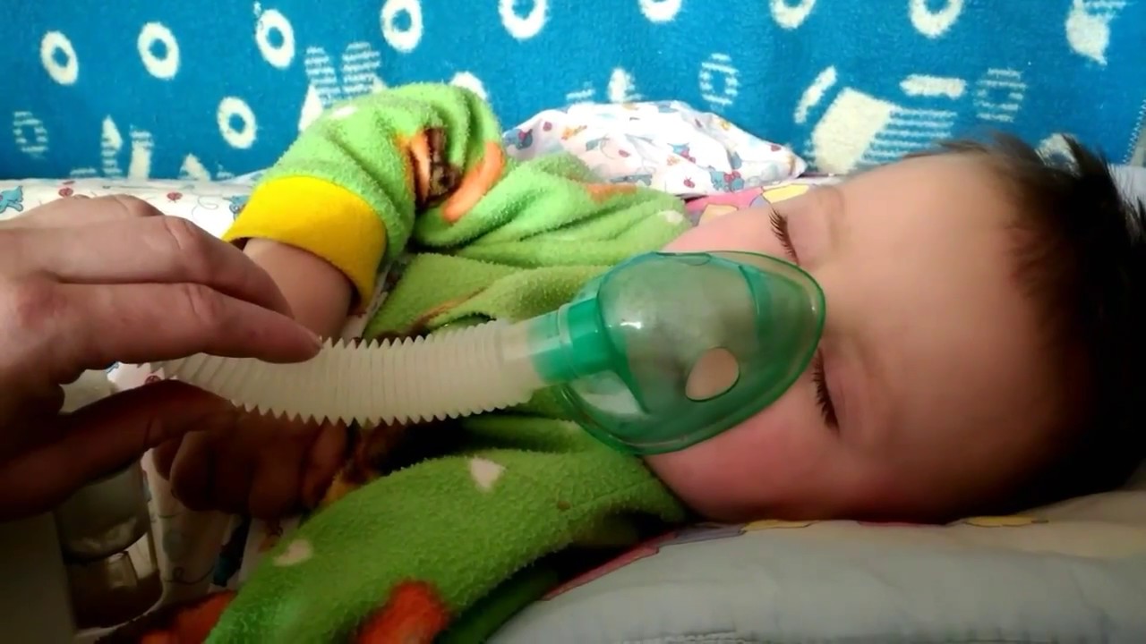 меш небулайзер омрон. маска для астмы детей. ингаляция для грудного ребенка от кашля. ингалятор для грудничков от кашля. ингаляция для трахеостомы.