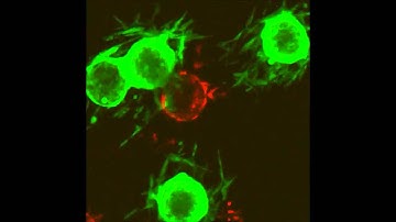 TGF-β1-induced EMT promotes targeted migration of breast cancer cells through the lymphatic...