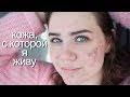 ИСТОРИЯ МОЕЙ КОЖИ / ПОМОГИТЕ || Инесса Мудрова