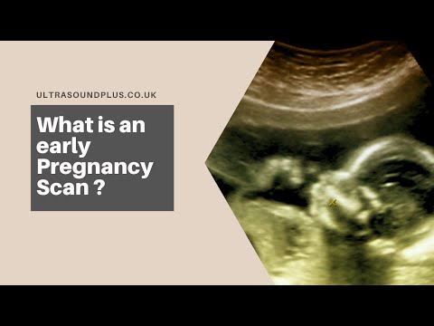 Early pregnancy scan Birmingham | Birmingham early pregnancy scans are available now.