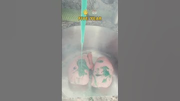 Are you neglecting your 🫁 start being proactive instead of being reactive. #ytshorts #mullein