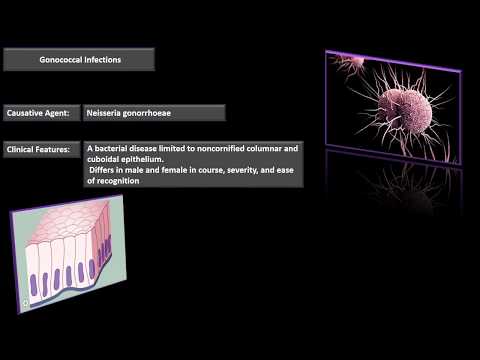 Video: Gonococcal Sepsis Hos En 32-årig Kvinde: En Sagsrapport
