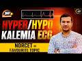 Hyperkalemia & Calcium Imbalance ECG Changes | 360° One Shot Series 🔥| Siddharth Sandu Sir