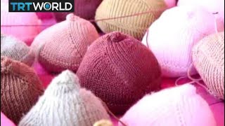 Breast Prosthethics: Cancer survivors helped in regaining confidence