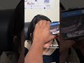Use MeiboVue to educate patient about dry eye