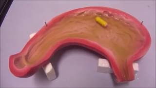 tadpole endoscope