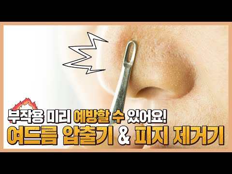 피지제거기와 <strong>여드름압출기</strong> 부작용 없이 사용하기 위한 단 한가지 원칙