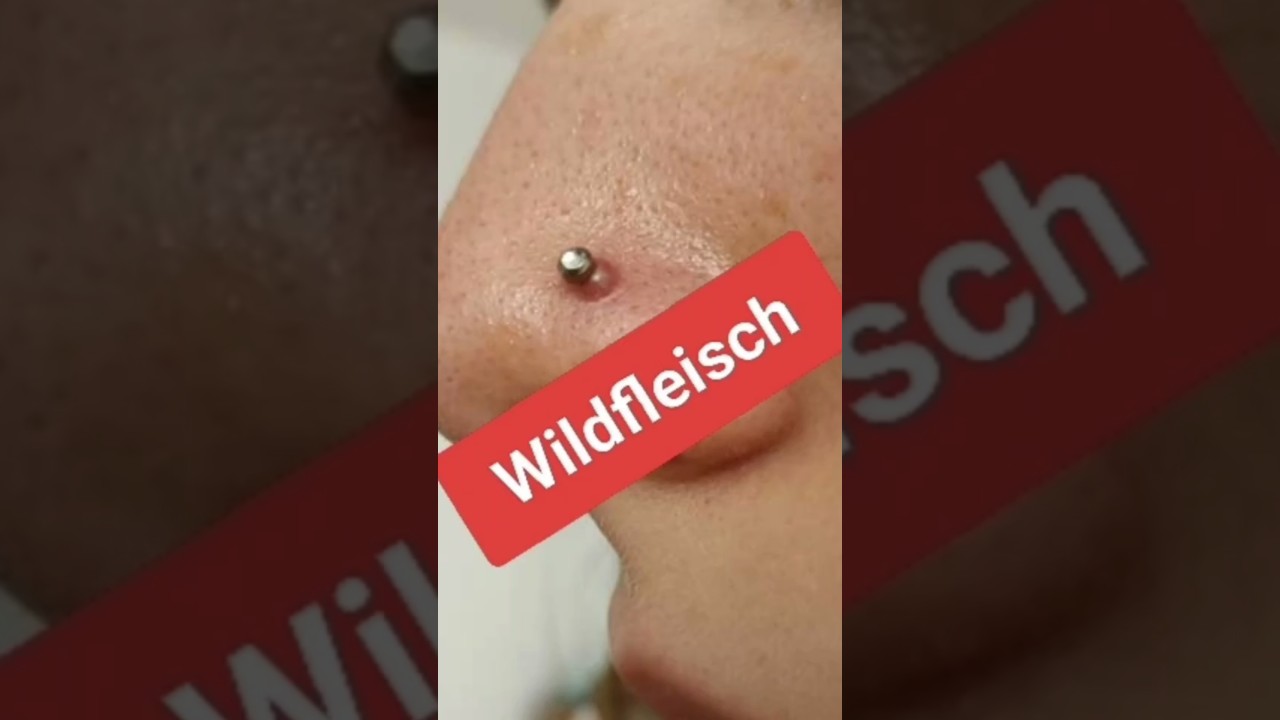 Wildfleisch Am Piercing⁉️ Wir Sagen Euch Was Wir Unseren Kunden Gegen Wildfleisch Empfehlen