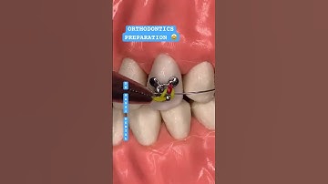 ORTHODONTICS PREPARATION 🤩🦷