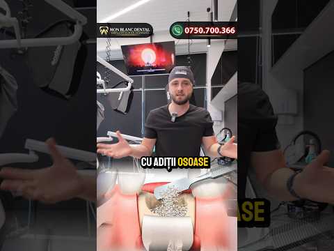 Nu ai suficient os în zona maxilarului? Dr doctor îți explică de ce NU ai nevoie de adiții osoase