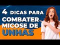 4 Dicas para Combater Micose de Unhas - Dr Lucas Fustinoni