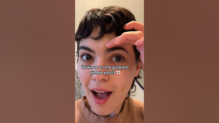 😩 Can’t believe this pimple patch peel! 😍🤌 #pimplepatch #pimplesolution