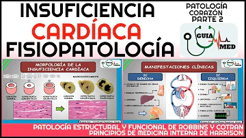 ¿Qué es la insuficiencia cardíaca en estadio 1?