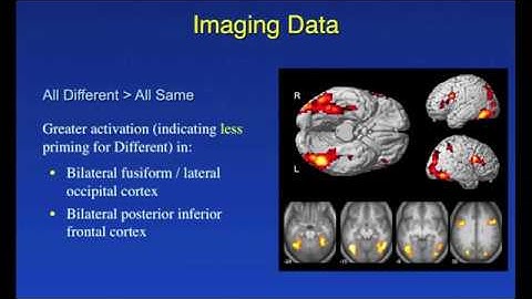 Neural bases of repetition priming